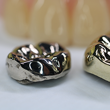 金属アレルギー治療